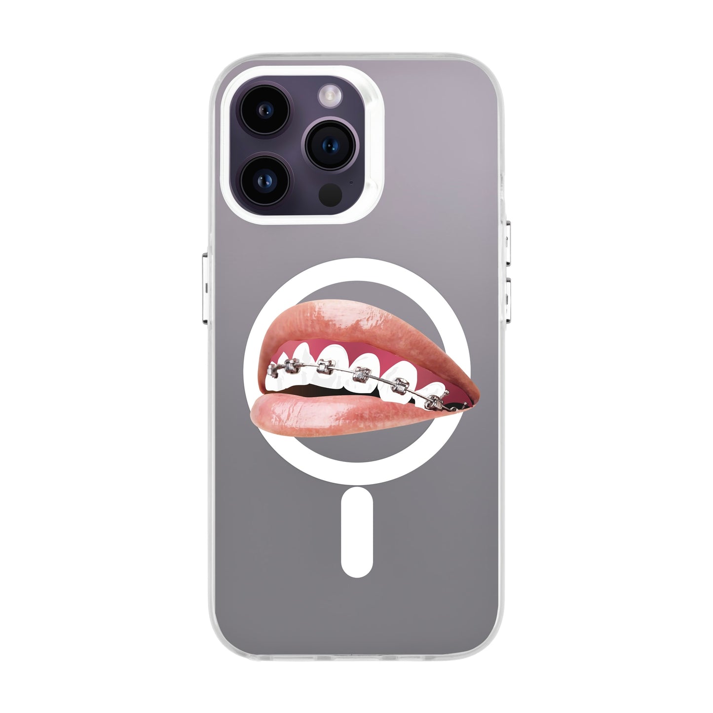 ORTHODONTIST-iPhone 14 Pro Max Hold Kılıf MagSafe Özellikli
