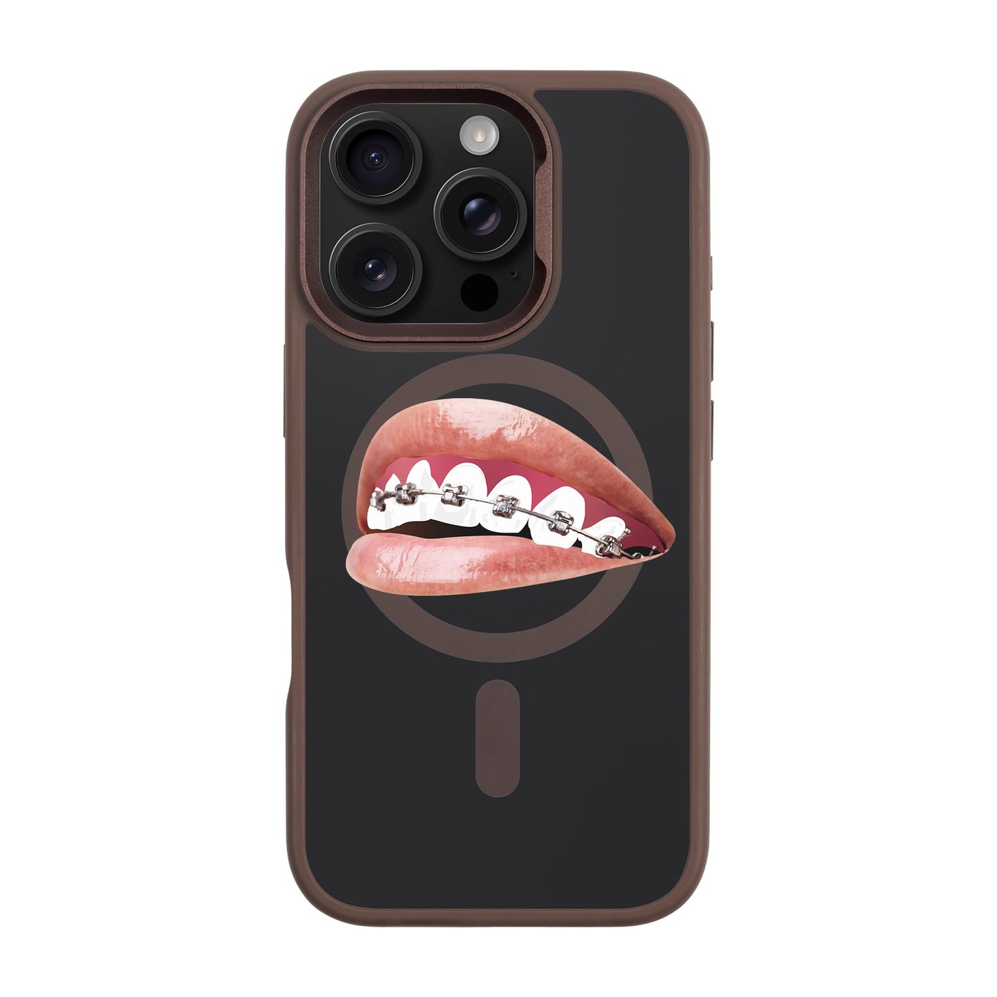 ORTHODONTIST-iPhone 16 Pro Rise Kılıf MagSafe Özellikli