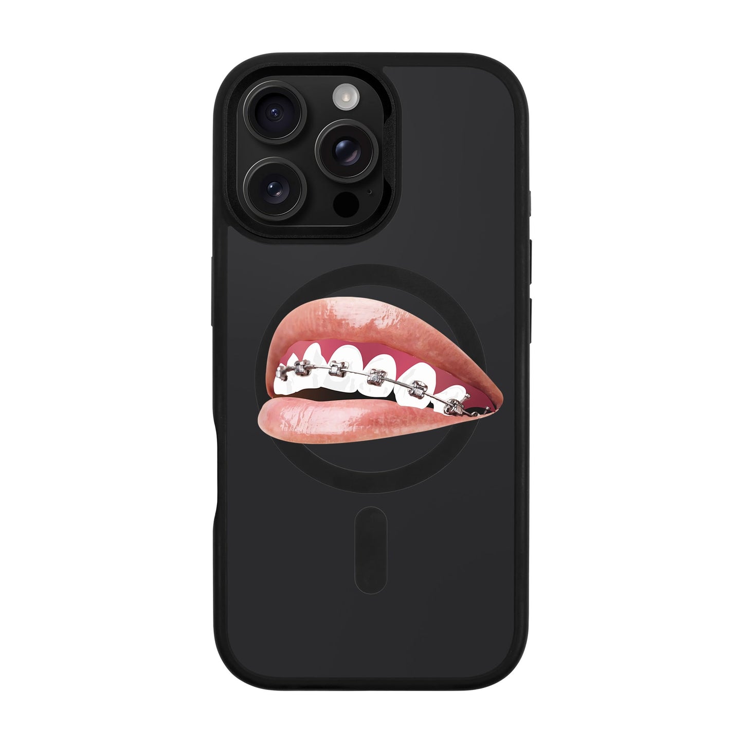 ORTHODONTIST-iPhone 16 Pro Max Rise Kılıf MagSafe Özellikli