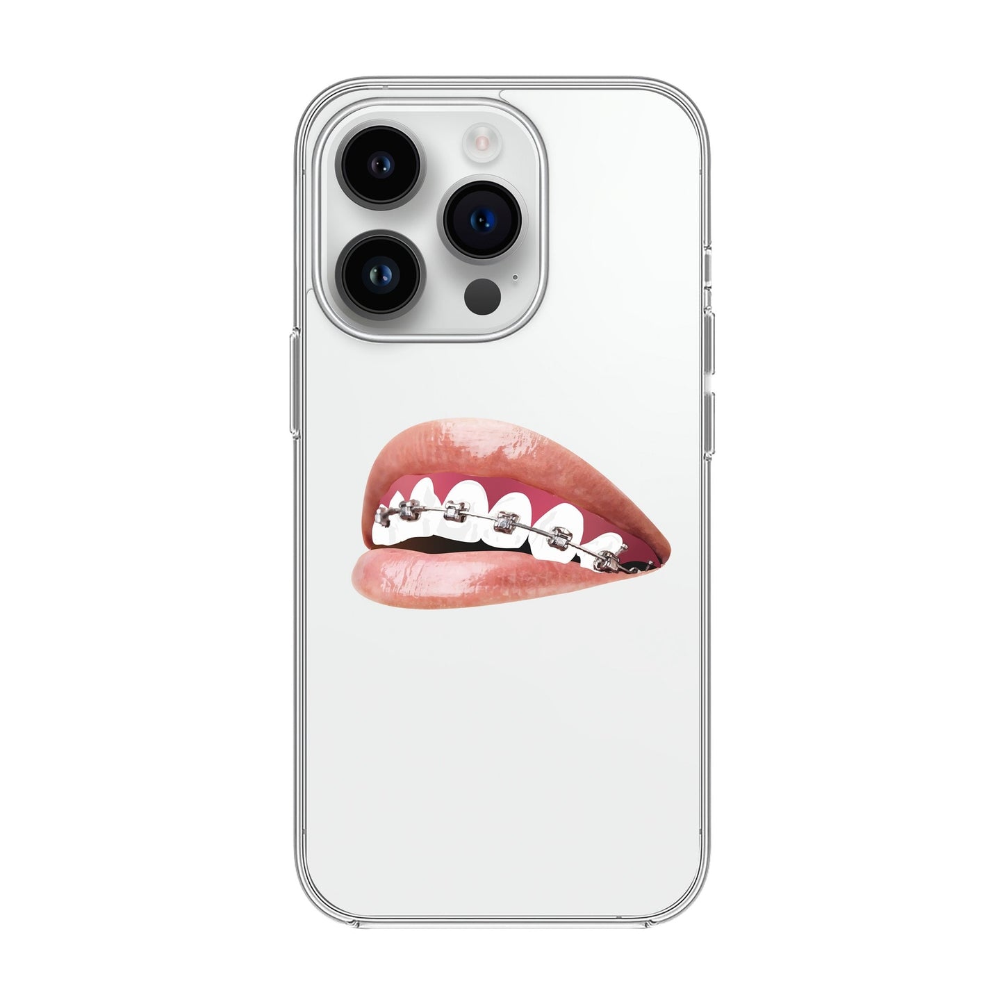 ORTHODONTIST-iPhone 14 Pro Solid Kılıf