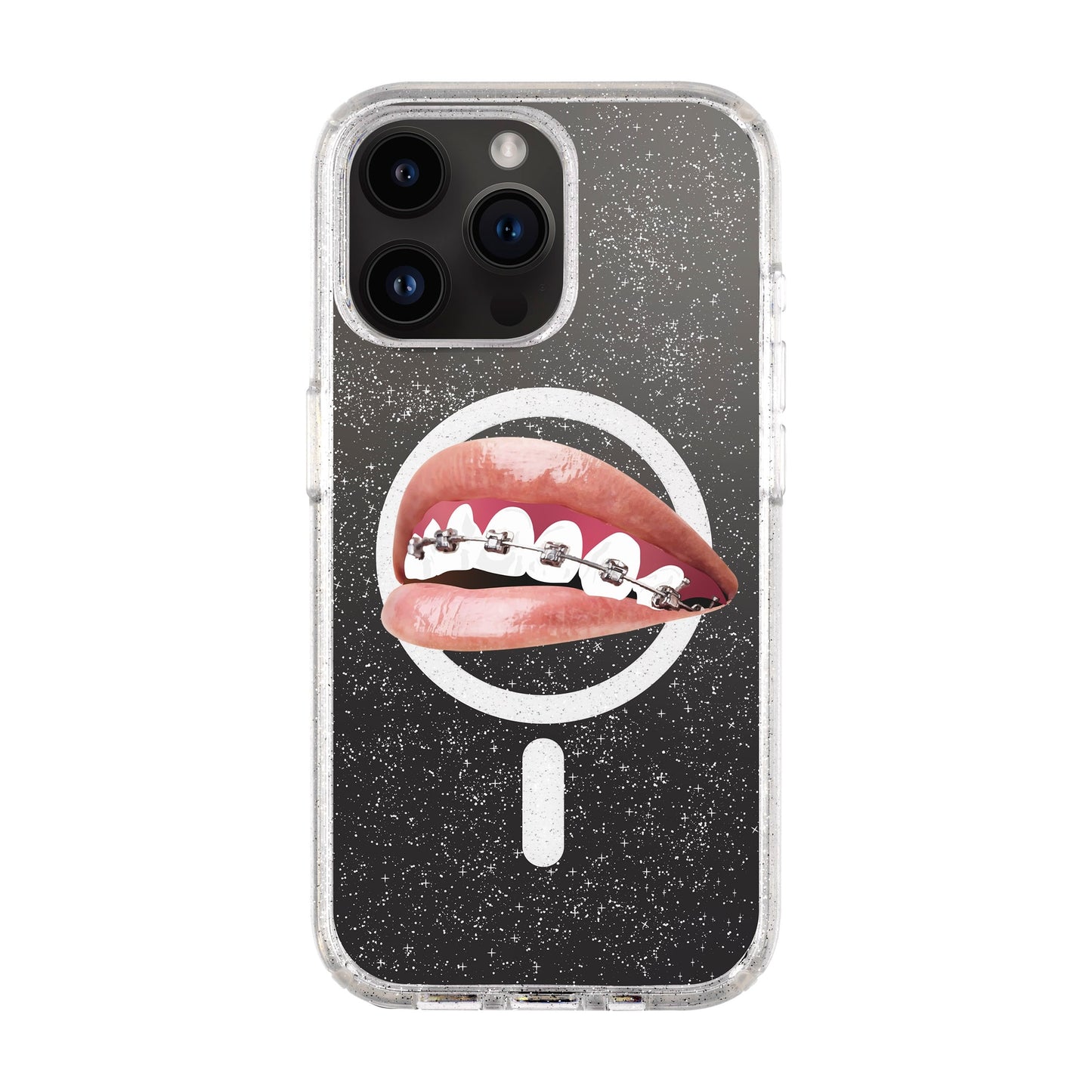 ORTHODONTIST-iPhone 14 Pro Max Shiny Kılıf MagSafe Özellikli