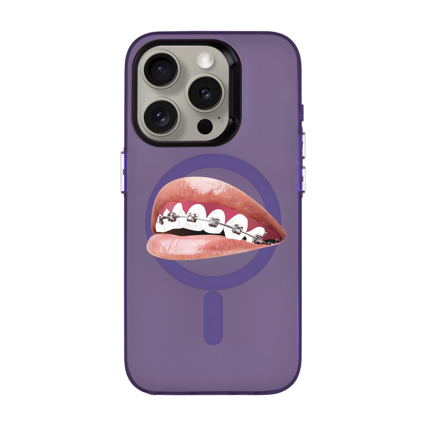 ORTHODONTIST-iPhone 15 Pro Hold Kılıf MagSafe Özellikli