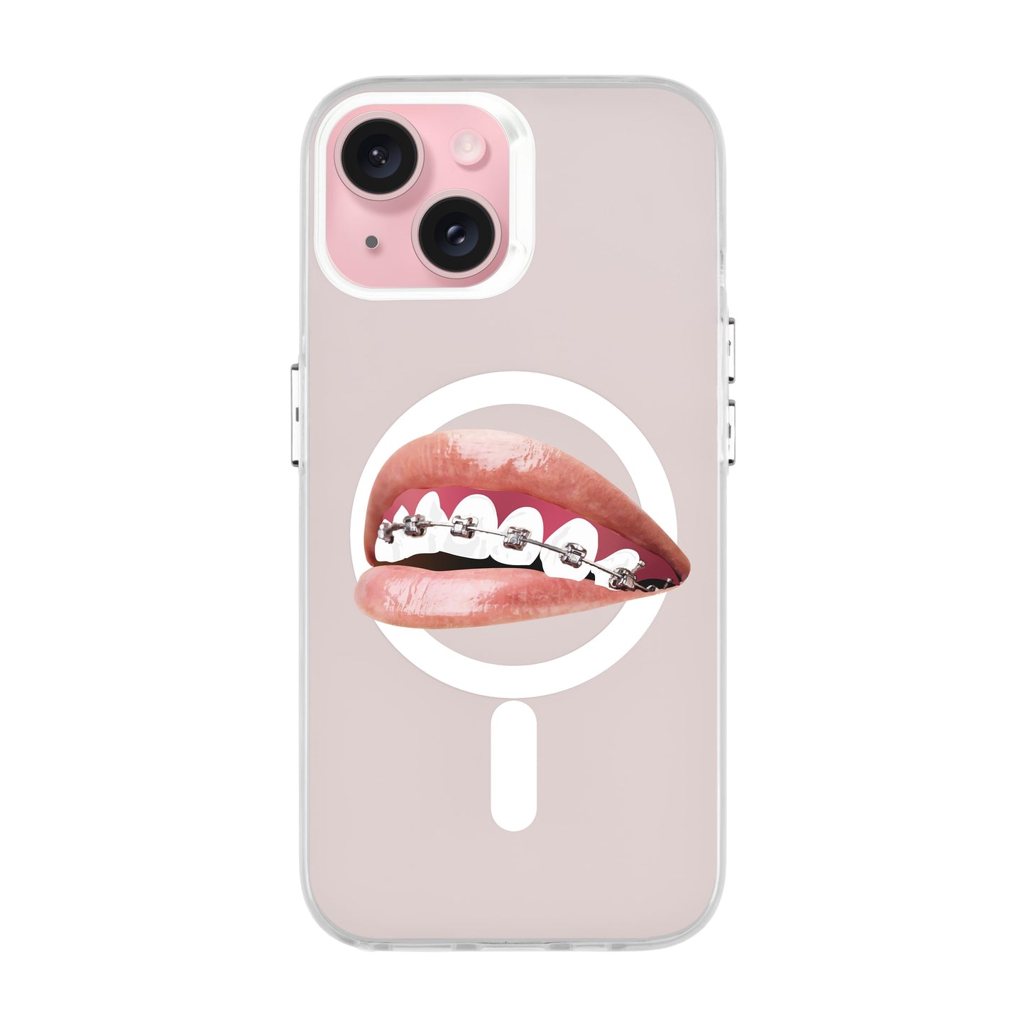 ORTHODONTIST-iPhone 15 Hold Kılıf MagSafe Özellikli