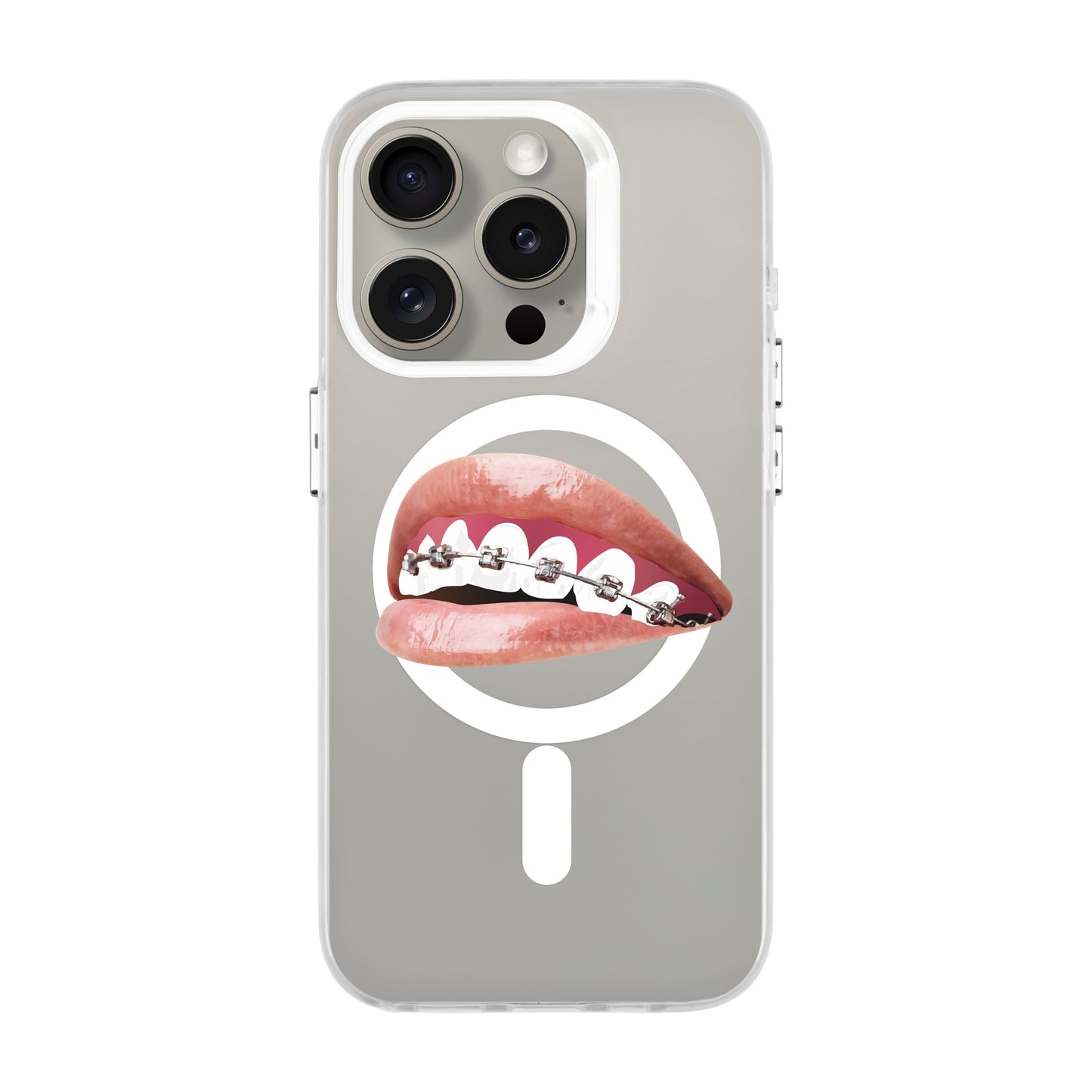 ORTHODONTIST-iPhone 15 Pro Hold Kılıf MagSafe Özellikli