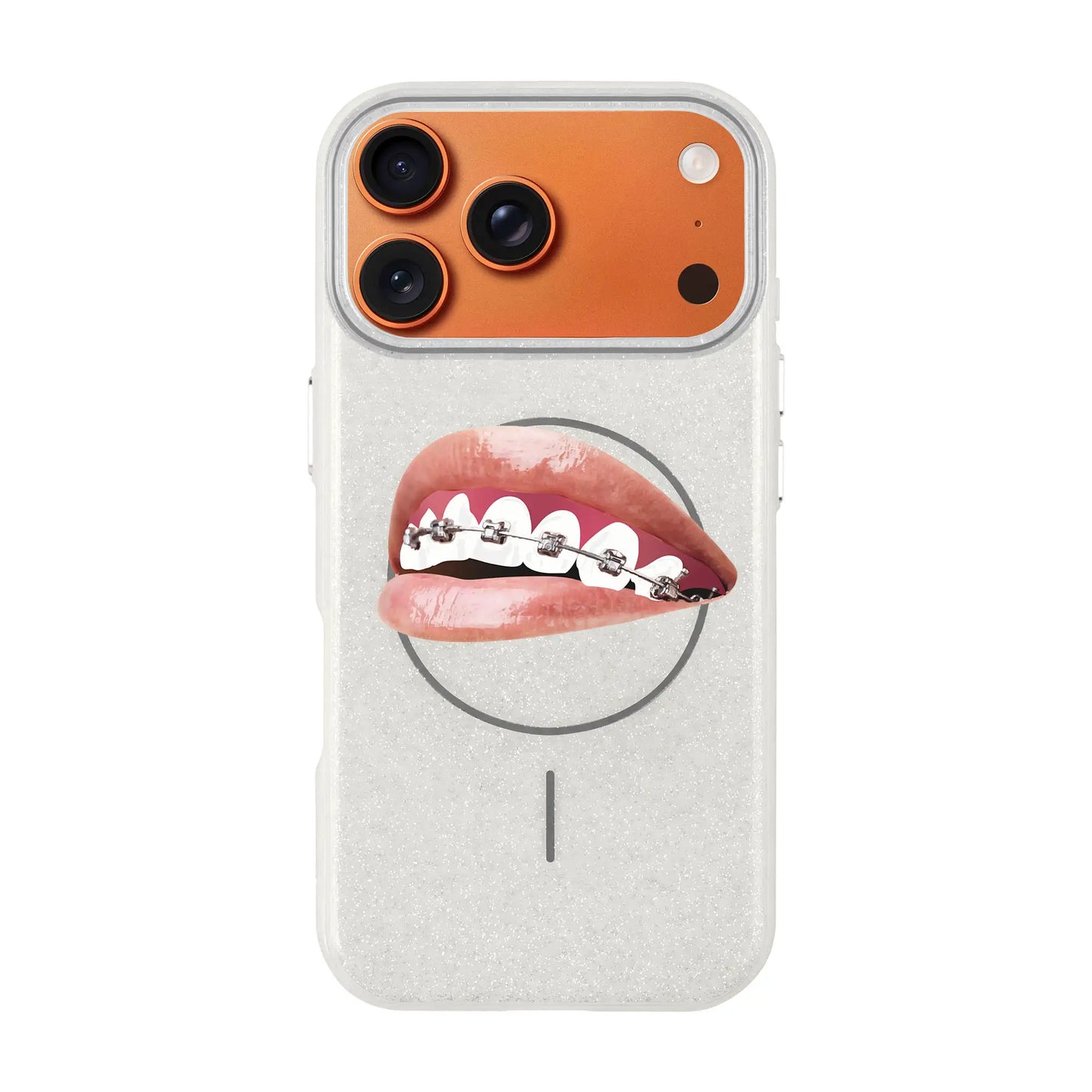 ORTHODONTIST-Radiant Kılıf MagSafe Özellikli - iPhone Air