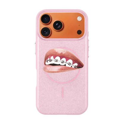 ORTHODONTIST-Radiant Kılıf MagSafe Özellikli - iPhone Air