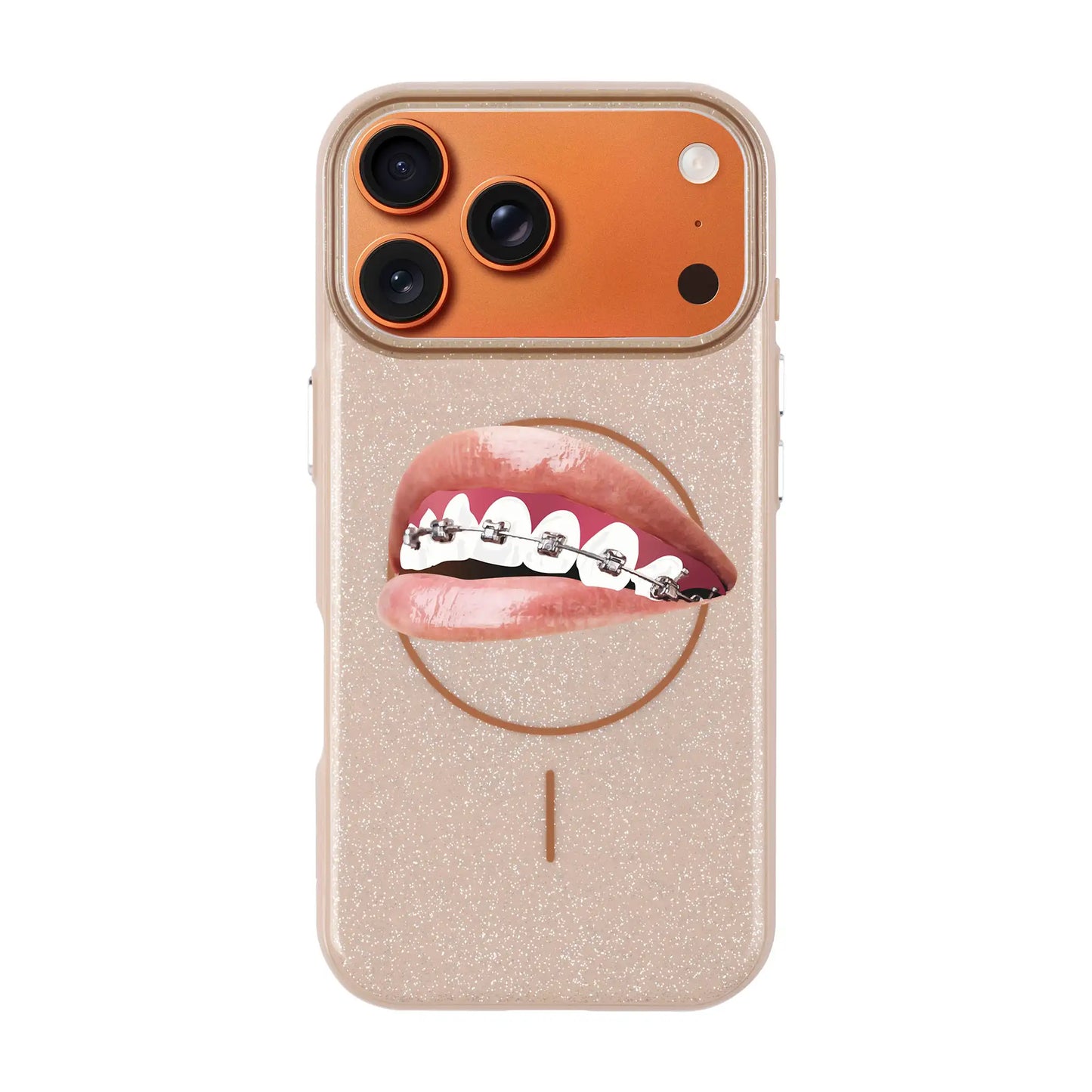 ORTHODONTIST-Radiant Kılıf MagSafe Özellikli - iPhone Air