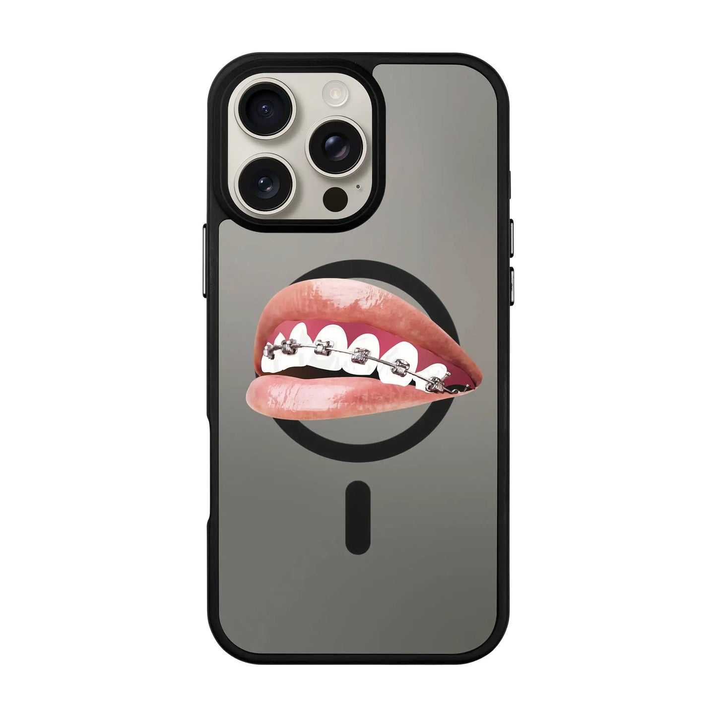 ORTHODONTIST-Blur Kılıf MagSafe Özellikli - iPhone 12 Pro Max