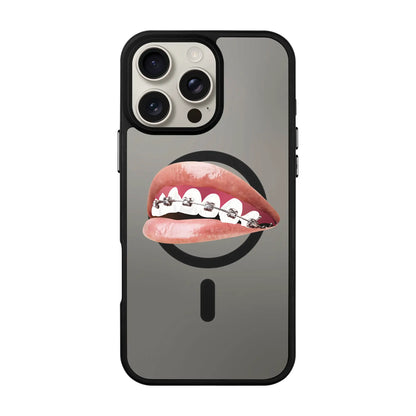 ORTHODONTIST-Blur Kılıf MagSafe Özellikli - iPhone 15