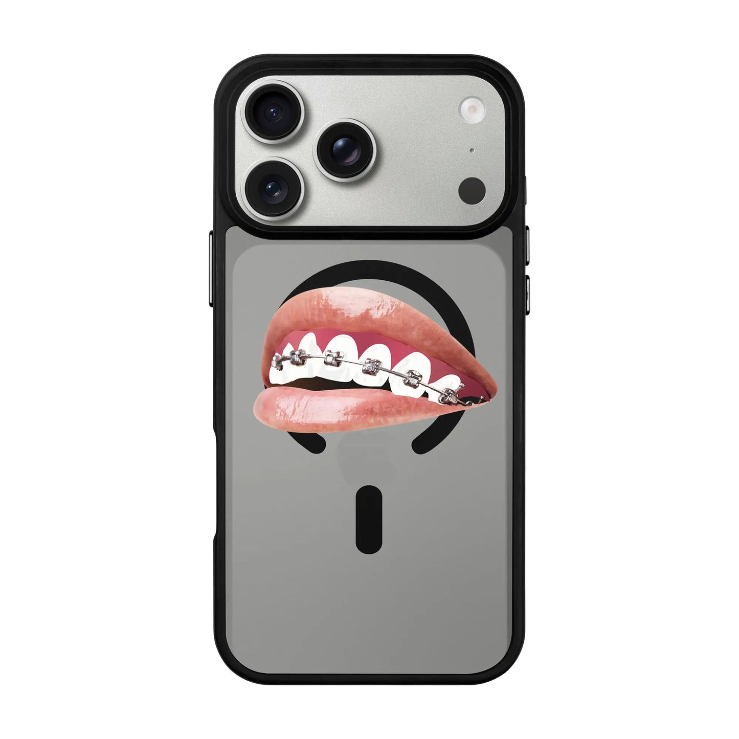 ORTHODONTIST-Blur Kılıf MagSafe Özellikli - iPhone 17