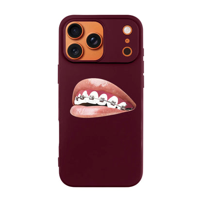 ORTHODONTIST-Ultra Silikon Kılıf-Oppo A76