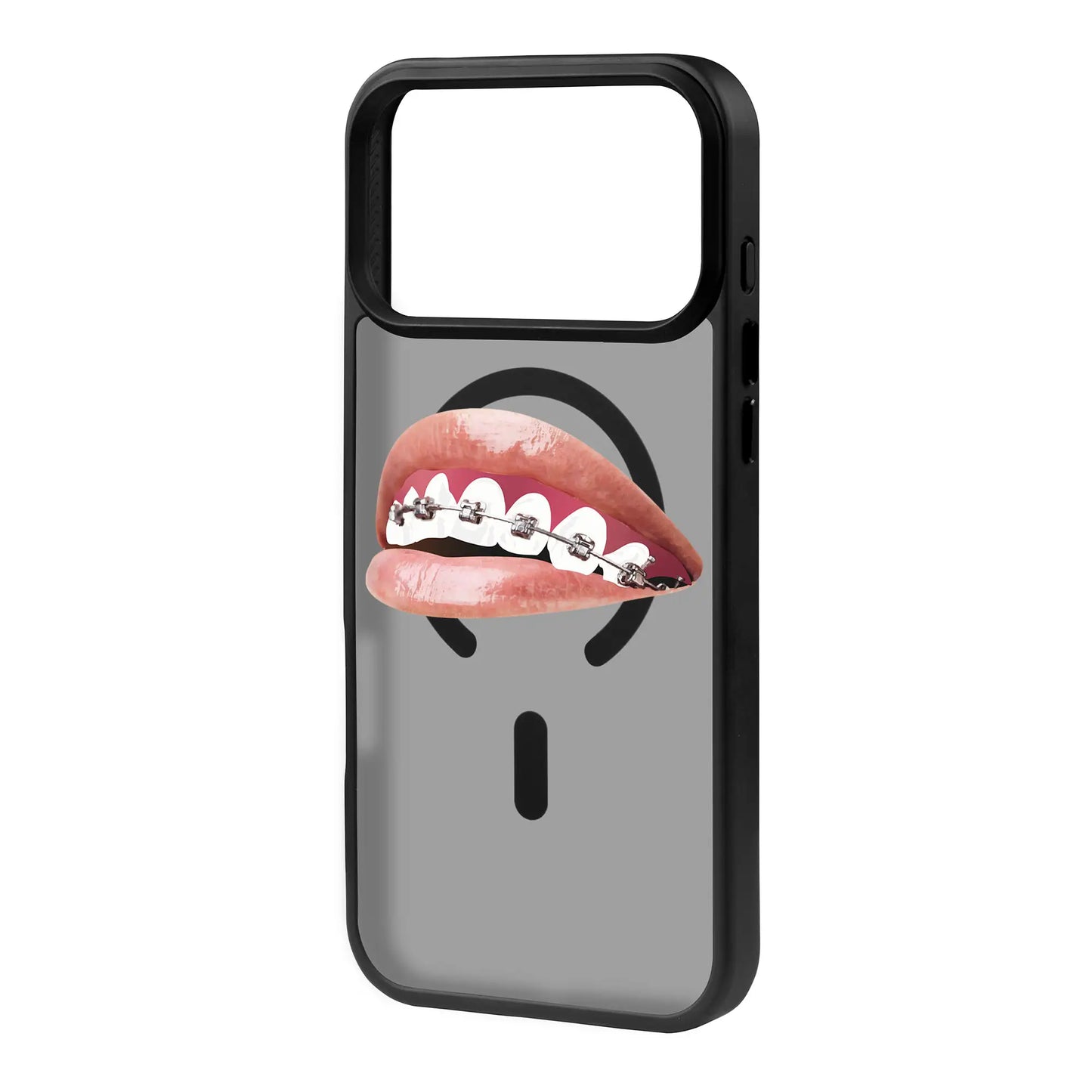 ORTHODONTIST-Blur Kılıf MagSafe Özellikli - iPhone 17 Pro
