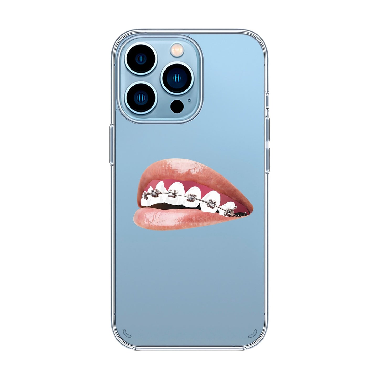ORTHODONTIST-iPhone X / Xs Solid Kılıf