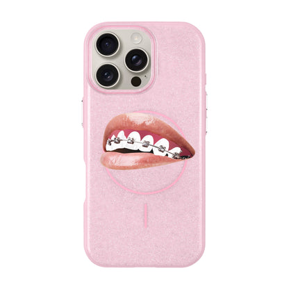ORTHODONTIST-iPhone 16 Pro Max Radiant Kılıf MagSafe Özellikli