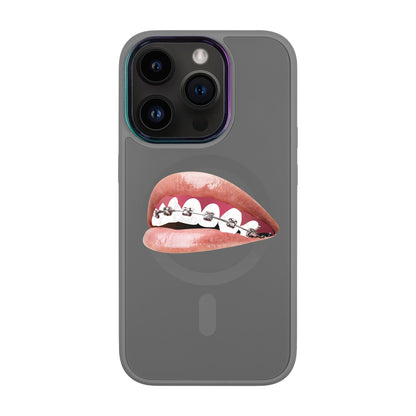 ORTHODONTİST-Vigor Kılıf MagSafe Özellikli - iPhone 14 Pro