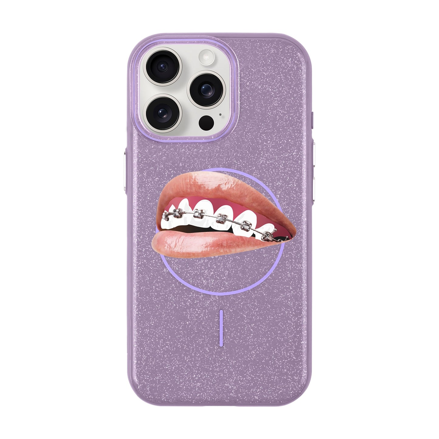 ORTHODONTIST-iPhone 15 Pro Max Radiant Kılıf MagSafe Özellikli