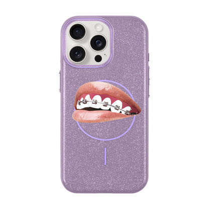 ORTHODONTIST-iPhone 15 Pro Max Radiant Kılıf MagSafe Özellikli