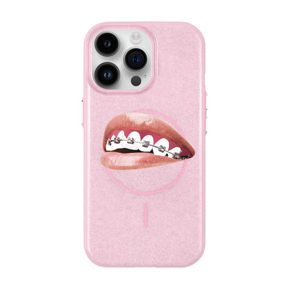 ORTHODONTIST-iPhone 14 Pro Max Radiant Kılıf MagSafe Özellikli