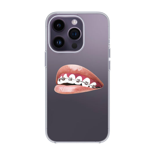 ORTHODONTIST-iPhone 14 Pro Solid Kılıf