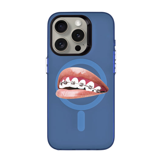 ORTHODONTIST-iPhone 15 Pro Hold Kılıf MagSafe Özellikli