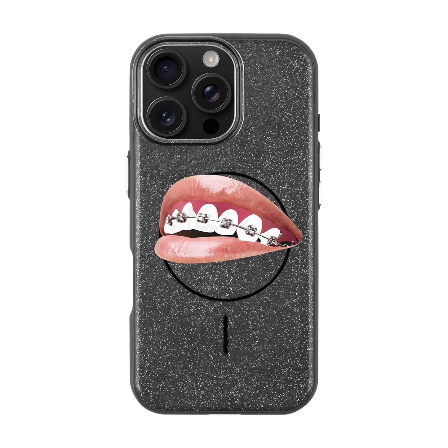 ORTHODONTIST-iPhone 16 Pro Max Radiant Kılıf MagSafe Özellikli
