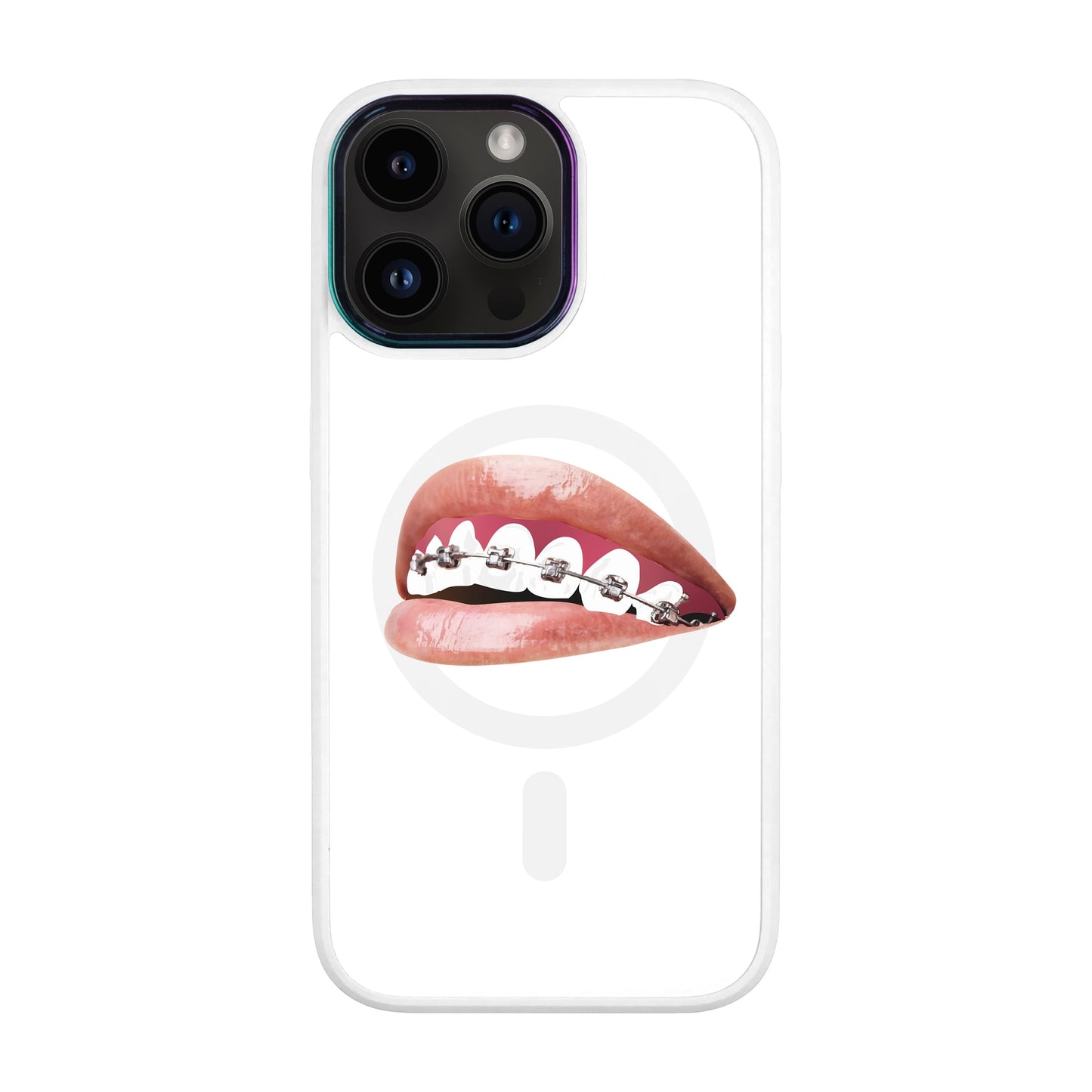 ORTHODONTİST-iPhone 14 Pro Max Vigor Kılıf MagSafe Özellikli