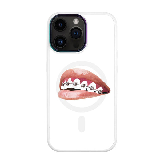 ORTHODONTİST-iPhone 14 Pro Max Vigor Kılıf MagSafe Özellikli