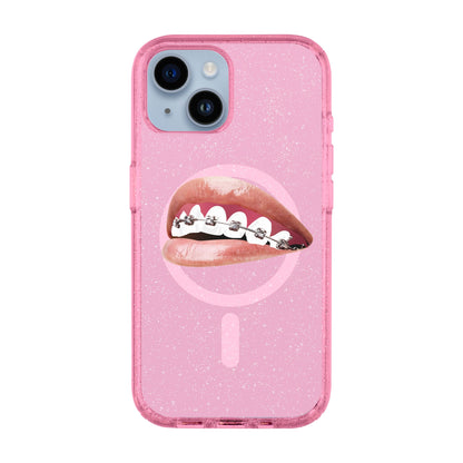 ORTHODONTIST-Shiny Kılıf MagSafe Özellikli - iPhone 14