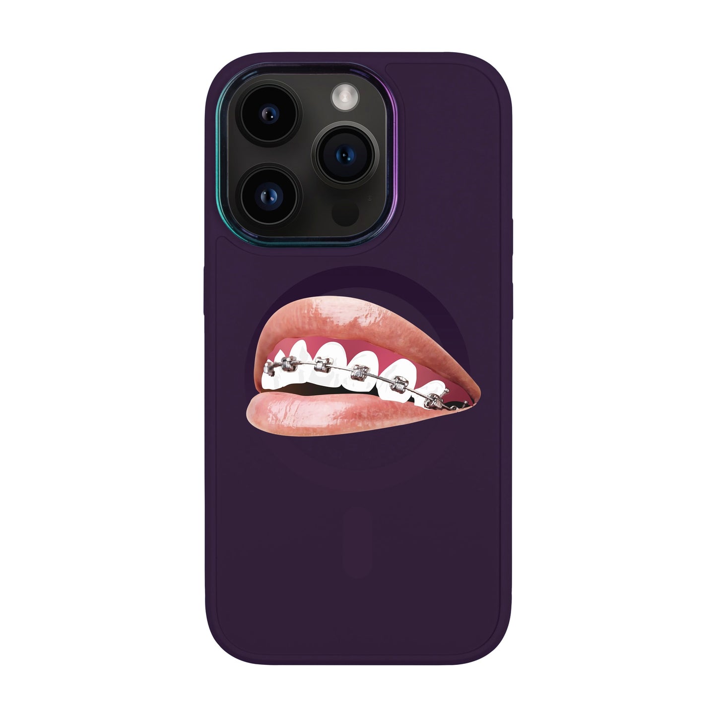 ORTHODONTİST-Vigor Kılıf MagSafe Özellikli - iPhone 14 Pro