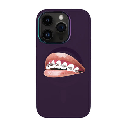 ORTHODONTİST-Vigor Kılıf MagSafe Özellikli - iPhone 14 Pro