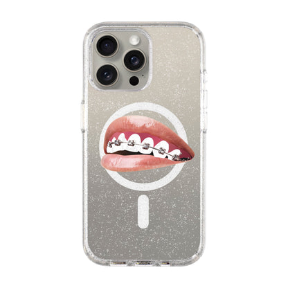 ORTHODONTIST-iPhone 15 Pro Max Shiny Kılıf MagSafe Özellikli