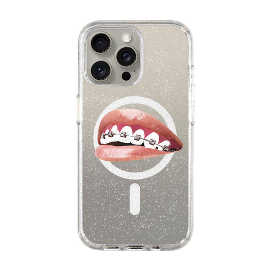 ORTHODONTIST-iPhone 15 Pro Max Shiny Kılıf MagSafe Özellikli