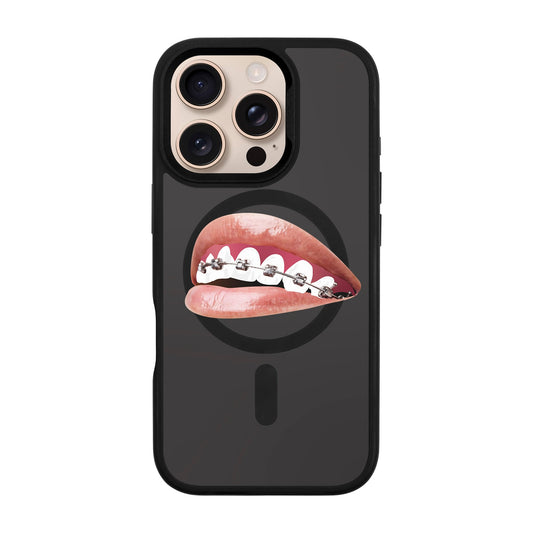 ORTHODONTIST-iPhone 16 Pro Rise Kılıf MagSafe Özellikli