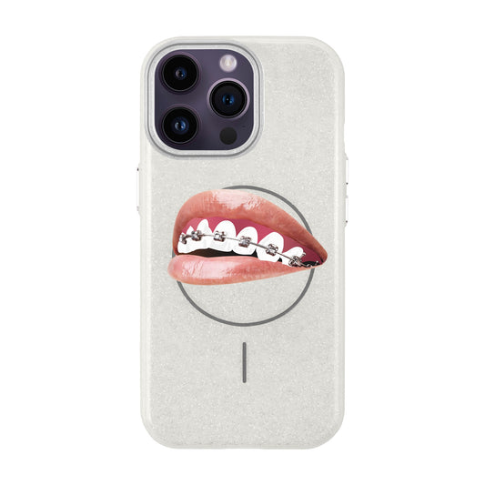 ORTHODONTIST-iPhone 14 Pro Max Radiant Kılıf MagSafe Özellikli