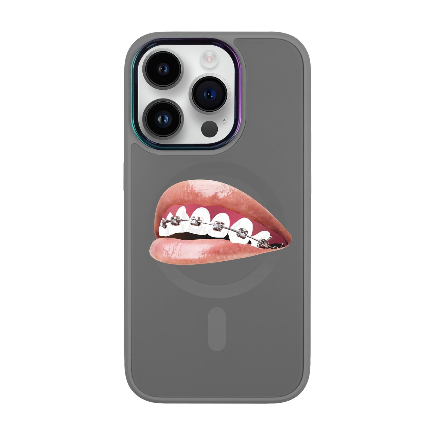ORTHODONTİST-Vigor Kılıf MagSafe Özellikli - iPhone 14 Pro