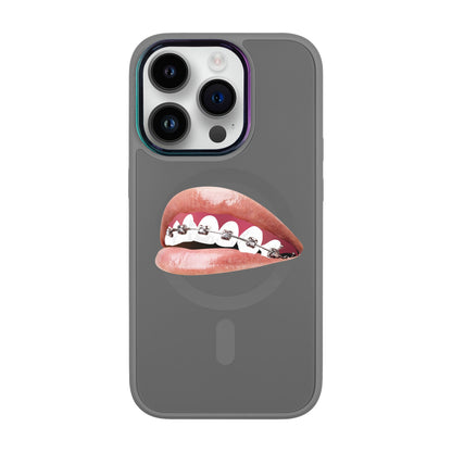 ORTHODONTİST-Vigor Kılıf MagSafe Özellikli - iPhone 14 Pro