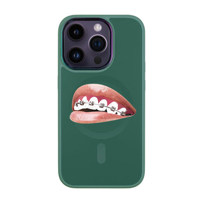 ORTHODONTİST-Vigor Kılıf MagSafe Özellikli - iPhone 14 Pro
