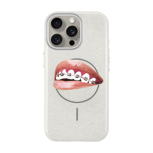 ORTHODONTIST-iPhone 15 Pro Max Radiant Kılıf MagSafe Özellikli