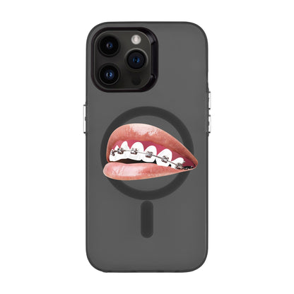 ORTHODONTIST-iPhone 14 Pro Max Hold Kılıf MagSafe Özellikli