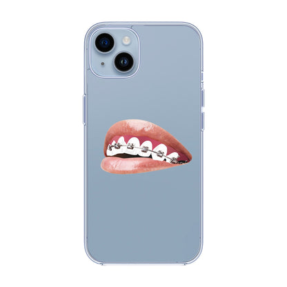 ORTHODONTIST-iPhone 14 Plus Solid Kılıf
