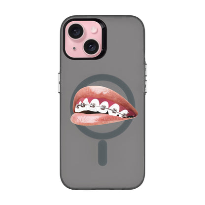 ORTHODONTIST-iPhone 15 Hold Kılıf MagSafe Özellikli