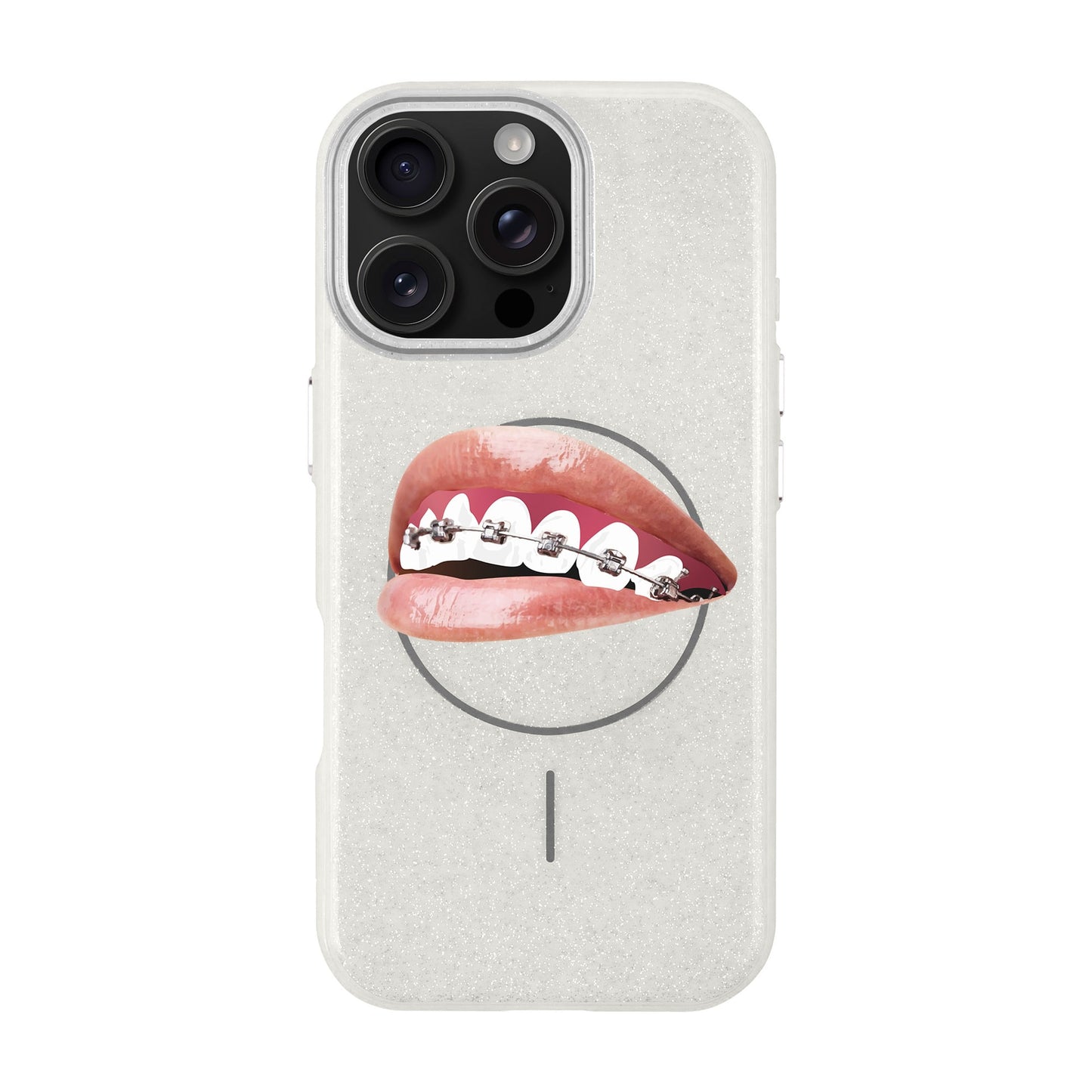 ORTHODONTIST-iPhone 16 Pro Max Radiant Kılıf MagSafe Özellikli