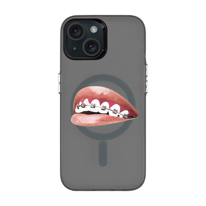 ORTHODONTIST-iPhone 15 Hold Kılıf MagSafe Özellikli