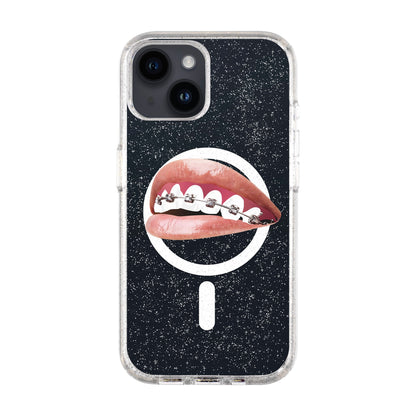 ORTHODONTIST-Shiny Kılıf MagSafe Özellikli - iPhone 13