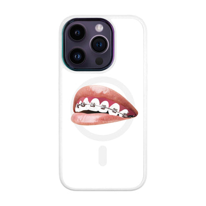 ORTHODONTİST-Vigor Kılıf MagSafe Özellikli - iPhone 14 Pro