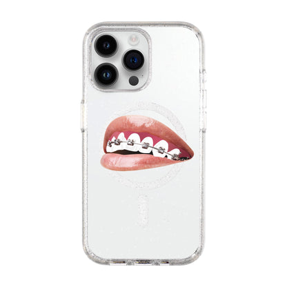 ORTHODONTIST-iPhone 14 Pro Max Shiny Kılıf MagSafe Özellikli