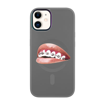 ORTHODONTİST-Vigor Kılıf MagSafe Özellikli - iPhone 11