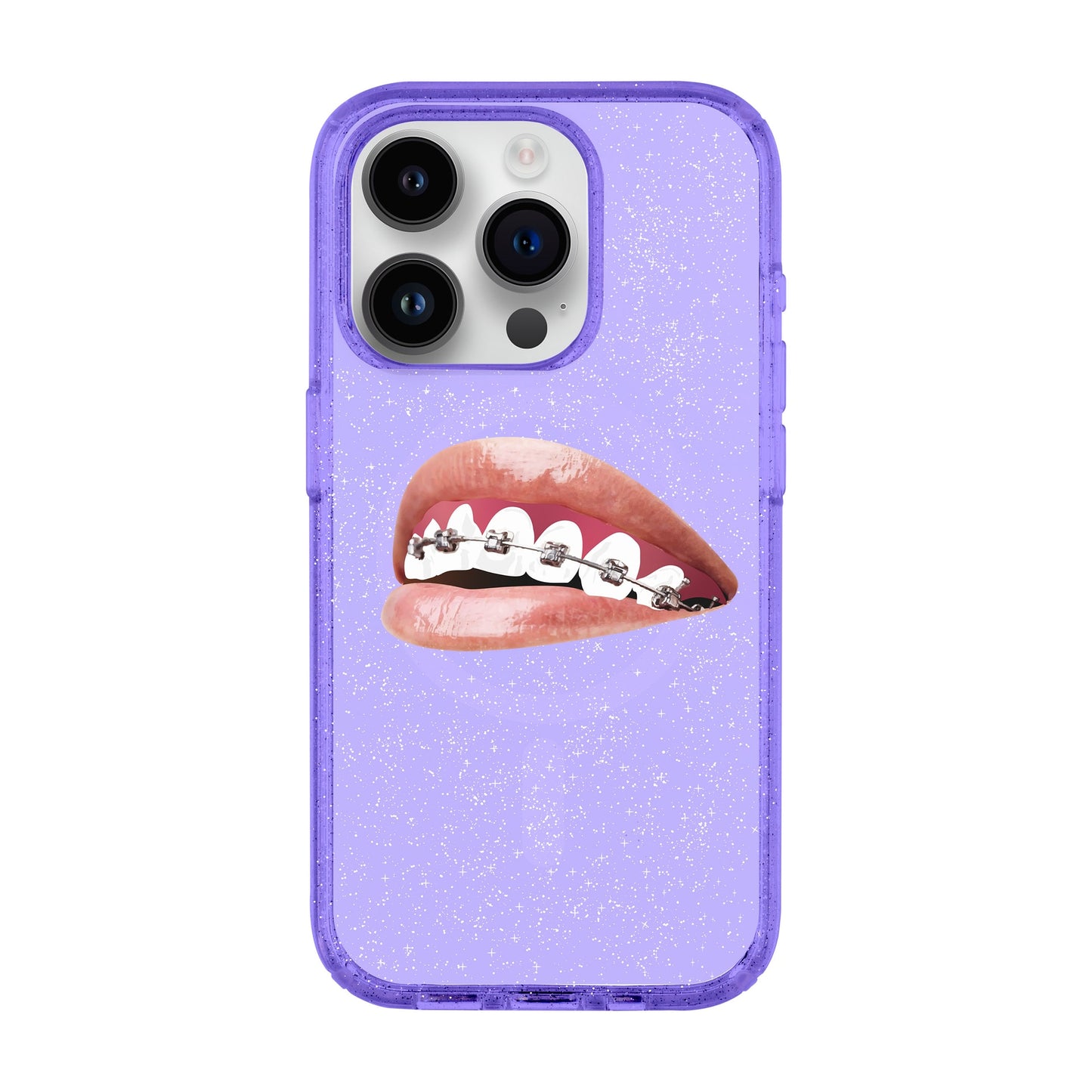 ORTHODONTIST-iPhone 14 Pro Shiny Kılıf MagSafe Özellikli