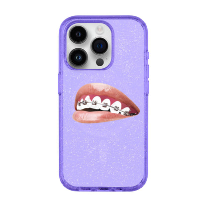 ORTHODONTIST-iPhone 14 Pro Shiny Kılıf MagSafe Özellikli