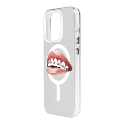 ORTHODONTIST-iPhone 15 Pro Hold Kılıf MagSafe Özellikli